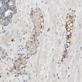 Anti-IL1RL1 antibody produced in rabbit Ab2, Prestige Antibodies® Powered by Atlas Antibodies, affinity isolated antibody, buffered aqueous glycerol solution