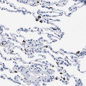 Anti-HLA-DQA1 antibody produced in rabbit Prestige Antibodies® Powered by Atlas Antibodies, affinity isolated antibody, buffered aqueous glycerol solution