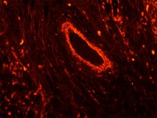单克隆抗波形蛋白抗体 clone V9, purified immunoglobulin, buffered aqueous solution