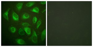 Anti-Calnexin, C-Terminal antibody produced in rabbit affinity isolated antibody