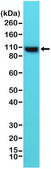 Anti-Alpha Actinin-4 antibody, Rabbit Monoclonal recombinant, expressed in HEK 293 cells, clone RM287, purified immunoglobulin