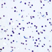 Anti-Histone H2AX antibody produced in rabbit