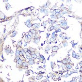 Anti-SSTR5 antibody produced in rabbit