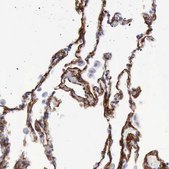 Anti-AOC3 antibody produced in rabbit Prestige Antibodies® Powered by Atlas Antibodies, affinity isolated antibody, buffered aqueous glycerol solution