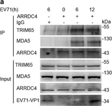 抗-TRIM65 兔抗 Prestige Antibodies® Powered by Atlas Antibodies, affinity isolated antibody, buffered aqueous glycerol solution, Ab2