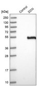 抗-DCN 兔抗 Prestige Antibodies® Powered by Atlas Antibodies, affinity isolated antibody, buffered aqueous glycerol solution