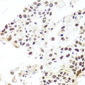 Anti- HIRA antibody produced in rabbit