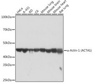 Anti-α-Actin-1 (ATCA1) antibody produced in rabbit