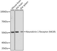 Anti-Neurokinin 1 Receptor (NK1R) Antibody, clone 9T1W2, Rabbit Monoclonal