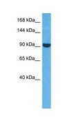 Anti-ACTN3 antibody produced in rabbit affinity isolated antibody