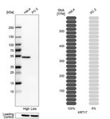 Anti-KRT17 antibody produced in rabbit Prestige Antibodies® Powered by Atlas Antibodies, affinity isolated antibody, buffered aqueous glycerol solution