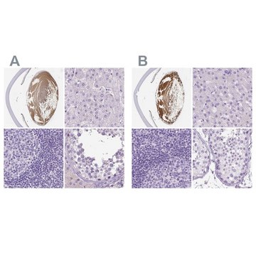 Anti-LGSN antibody produced in rabbit Prestige Antibodies® Powered by Atlas Antibodies, affinity isolated antibody, buffered aqueous glycerol solution