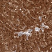 Anti-PGM1 antibody produced in rabbit Prestige Antibodies® Powered by Atlas Antibodies, affinity isolated antibody, buffered aqueous glycerol solution, Ab1