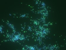 Porphyromonas gingivalis FISH probe - ATTO488 Probe for fluorescence in situ hybridization (FISH)