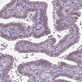 Anti-AREG antibody produced in rabbit Prestige Antibodies® Powered by Atlas Antibodies, affinity isolated antibody, buffered aqueous glycerol solution