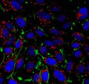 Anti-alpha-Actin Antibody, Smooth Muscle from rabbit, purified by affinity chromatography