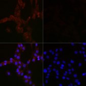 Anti-MAP1LC3B antibody produced in mouse