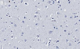 Anti-ADAR1 Antibody, clone 1I4-H1 ZooMAb® Rabbit Monoclonal recombinant, expressed in HEK 293 cells