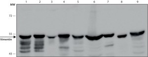 Anti-Vimentin antibody, Mouse monoclonal clone VIM-13.2, purified from hybridoma cell culture