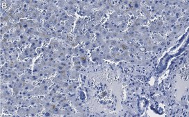 Anti-Caveolin-1 Antibody, clone 1D10 ZooMAb® Rabbit Monoclonal recombinant, expressed in HEK 293 cells