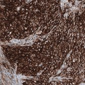 Anti-CD44 antibody produced in mouse Prestige Antibodies® Powered by Atlas Antibodies, clone CL13318, purified by using Protein A, buffered aqueous glycerol solution
