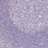 Anti-KIAA1210 antibody produced in rabbit Prestige Antibodies® Powered by Atlas Antibodies, affinity isolated antibody, buffered aqueous glycerol solution