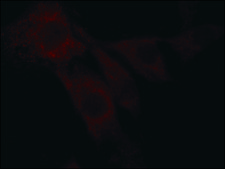 Anti-Superoxide Dismutase (MnSOD) (DD-17)−Cy3 antibody produced in rabbit 1-2 mg/mL, affinity isolated antibody, buffered aqueous solution