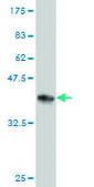 Monoclonal Anti-RRM2 antibody produced in mouse clone 1E1, purified immunoglobulin, buffered aqueous solution