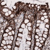 Monoclonal Anti-CS antibody produced in mouse Prestige Antibodies® Powered by Atlas Antibodies, clone CL2553, purified immunoglobulin, buffered aqueous glycerol solution