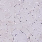 Anti-DAGLA antibody produced in rabbit Prestige Antibodies® Powered by Atlas Antibodies, affinity isolated antibody, buffered aqueous glycerol solution