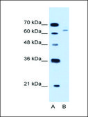 Anti-CBS antibody produced in rabbit IgG fraction of antiserum