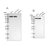 Anti-ACLY antibody produced in rabbit Prestige Antibodies® Powered by Atlas Antibodies, affinity isolated antibody, buffered aqueous glycerol solution