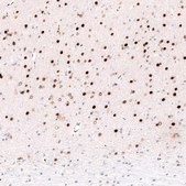 Monoclonal Anti-FOXP2 antibody produced in mouse Prestige Antibodies® Powered by Atlas Antibodies, clone CL5312, purified immunoglobulin, buffered aqueous glycerol solution