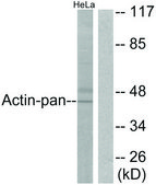 Anti-Actin-pan, C-Terminal antibody produced in rabbit affinity isolated antibody