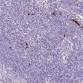 Anti-LYZ antibody produced in rabbit Prestige Antibodies® Powered by Atlas Antibodies, affinity isolated antibody, buffered aqueous glycerol solution