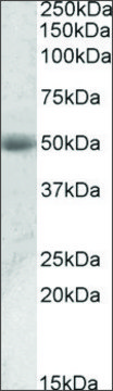 Anti-ACPP antibody produced in goat affinity isolated antibody, buffered aqueous solution