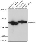 Anti-Catalase antibody produced in rabbit