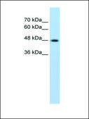 Anti-KRT17 antibody produced in rabbit affinity isolated antibody