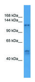 Anti-COL1A1 (C-terminal) antibody produced in rabbit affinity isolated antibody