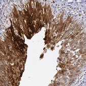 抗-COX2 兔抗 Prestige Antibodies® Powered by Atlas Antibodies, affinity isolated antibody, buffered aqueous glycerol solution