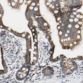 Anti-CLPP antibody produced in rabbit Prestige Antibodies® Powered by Atlas Antibodies, affinity isolated antibody, buffered aqueous glycerol solution