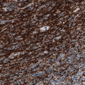 Monoclonal Anti-CNP antibody produced in mouse Prestige Antibodies® Powered by Atlas Antibodies, clone CL2871, purified immunoglobulin, buffered aqueous glycerol solution