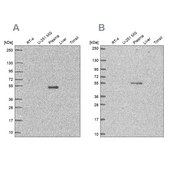 Anti-EED antibody produced in rabbit Prestige Antibodies® Powered by Atlas Antibodies, affinity isolated antibody, buffered aqueous glycerol solution