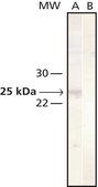 Monoclonal Anti-Cathepsin L antibody produced in mouse clone 33/2, ascites fluid