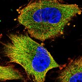 Anti-NDUFAF1 antibody produced in rabbit Prestige Antibodies® Powered by Atlas Antibodies, affinity isolated antibody, buffered aqueous glycerol solution
