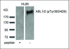抗-磷酸化-ABL1/ABL2 (pTyr393/429) 兔抗 affinity isolated antibody