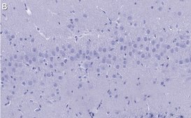 Anti-Synaptophysin Antibody, clone 2B21, ZooMAb® Rabbit Monoclonal recombinant, expressed in HEK 293 cells