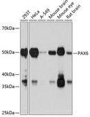 Anti-PAX6 antibody produced in rabbit
