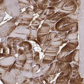 Anti-ACTN2 antibody produced in rabbit Prestige Antibodies® Powered by Atlas Antibodies, affinity isolated antibody, buffered aqueous glycerol solution