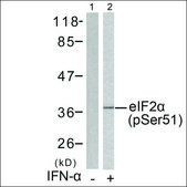 Anti-phospho-EIF2S1 (pSer51) antibody produced in rabbit affinity isolated antibody